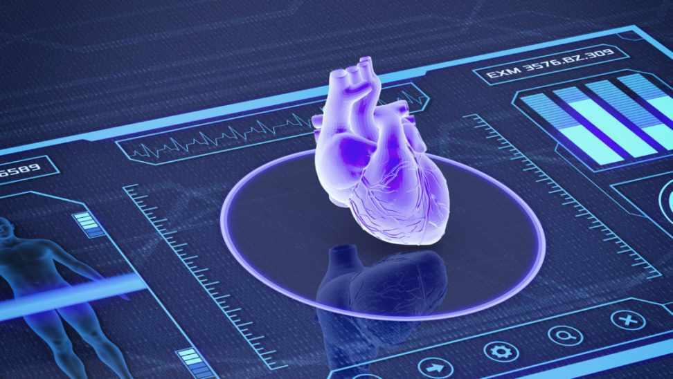 Heart Monitoring Technology