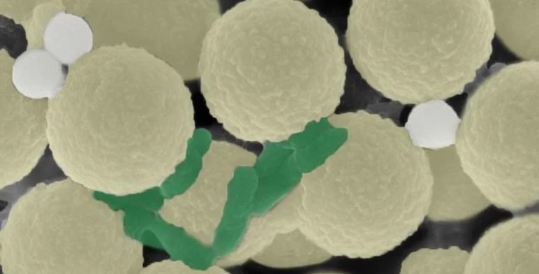 To clean water, researchers have designed swarms of tiny, spherical robots (light yellow) that collect bacteria (green) and small pieces of plastic (gray)