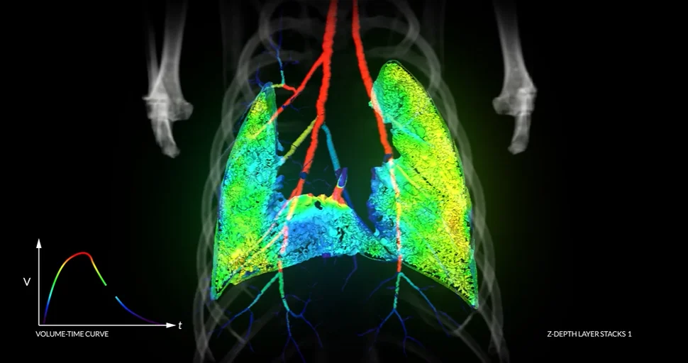 Live XV 4D Scan