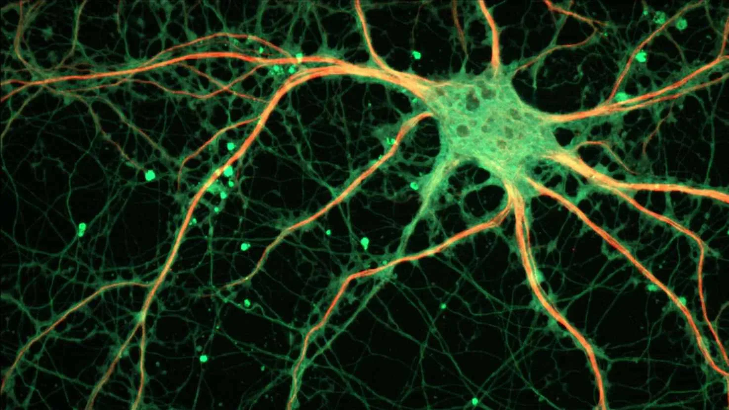 Brain cells in dish taught to play Pong in experiment